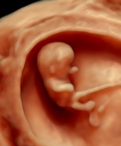 Experience Your Pregnancy Journey with Private Ultrasound in Perth