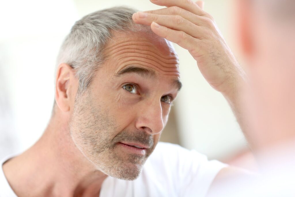 Is a Hair Transplant Right for You: Key Factors to Consider